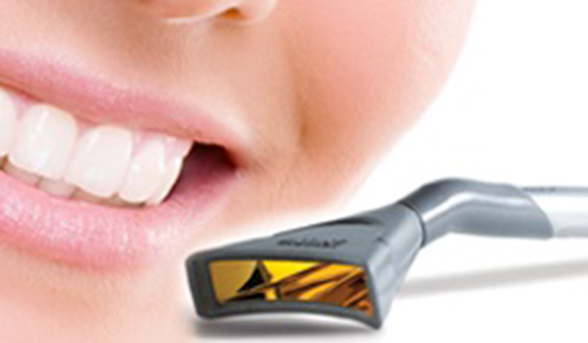 Blanchiment laser Epic