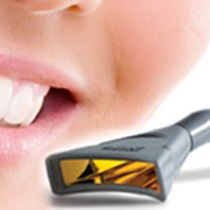 Blanchiment des dents au laser