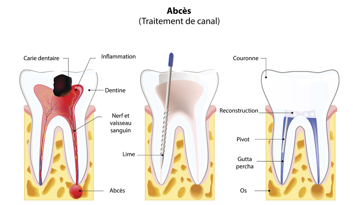 Endodontie