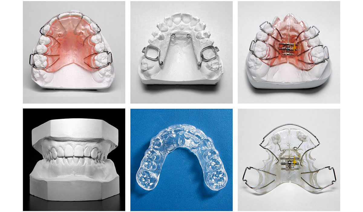 Orthodontie amovible